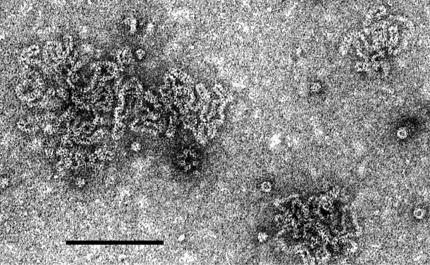 Представитель Семейства Ophioviridae